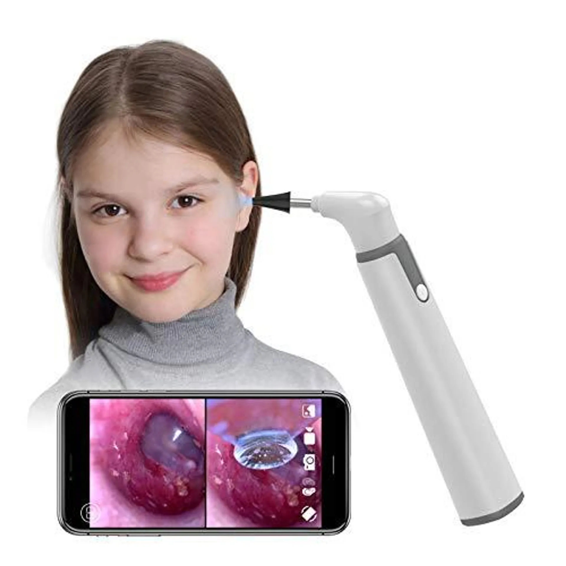 Feng Rao Wireless Otoscope Ear Camera with Dual View, 3.9mm 720PHD WiFi Ear Scope with 6 LED Lights for Kids and Adults, Compatible